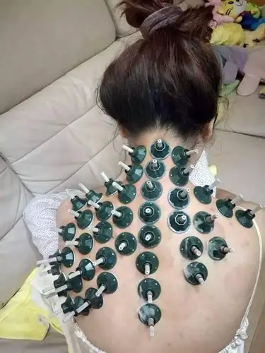 真实案例,艾灸调理颈椎病