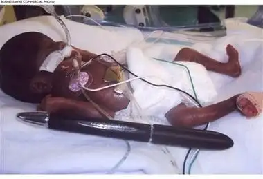 图为出生时仅有240厘米长的阿梅里亚.