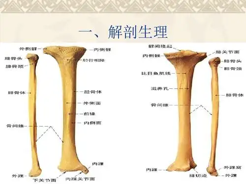 胫腓骨骨折护理ppt