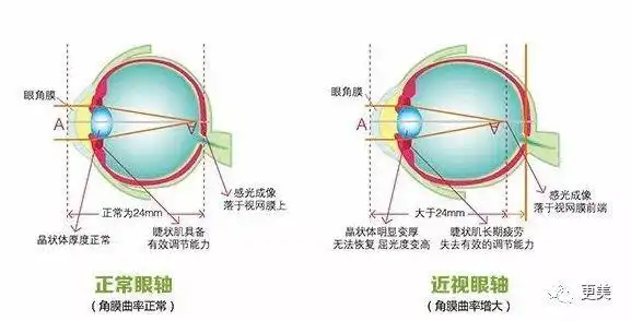 正常人眼球突出度是在12~14mm,双眼相差不到2mm,一般男性是13.