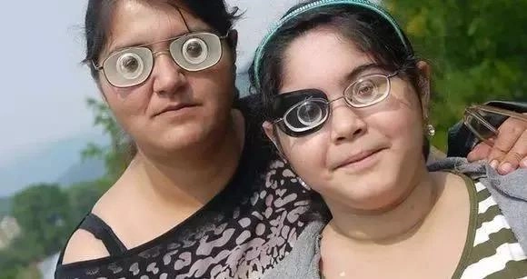 3400度近视的真人真事注意看母亲戴的镜片超出你的想象