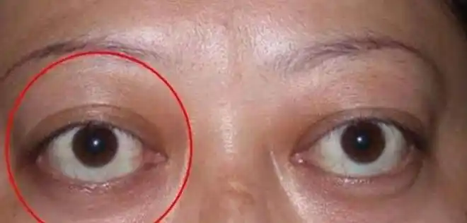 摘下眼镜后,眼前模糊导致大脑收集不到信息,也就不会支配眼睛作出行动