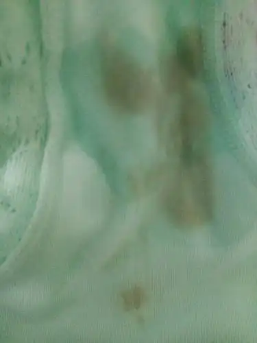 从上月经结束两天后 下面一直偶尔流水 今天突然看到内裤上有这个 是