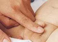 男婴篇:如何清洁宝宝的性器官?