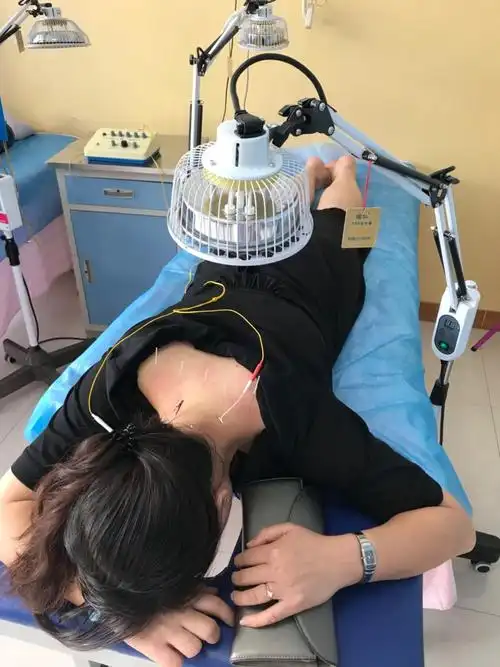 富县人民医院中医综合科——针灸篇(一)