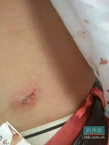 潮州狂徒持枪街头射伤5人警方定性聚众斗殴9月16日凌