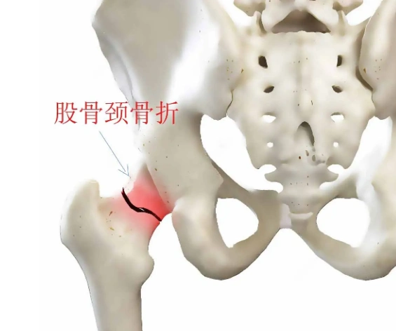 编辑1解剖结构承重作用大腿骨俗称femur外文名人体中最大的长管状骨[1