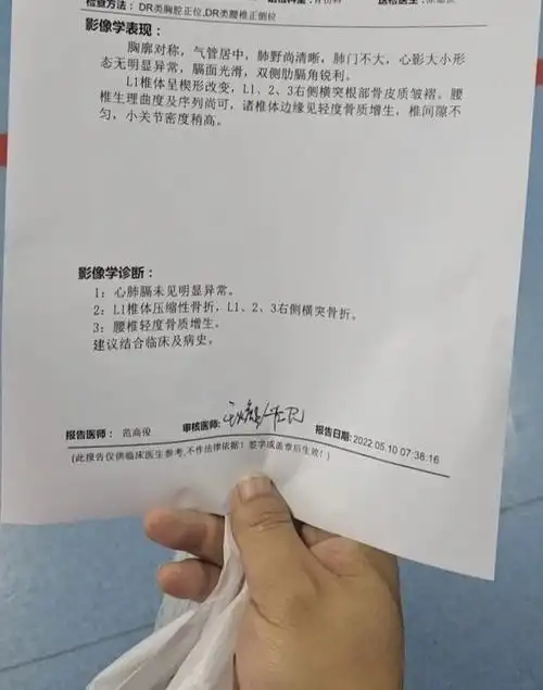 也不知道自己压缩性骨折是几分之一,应该下个月能