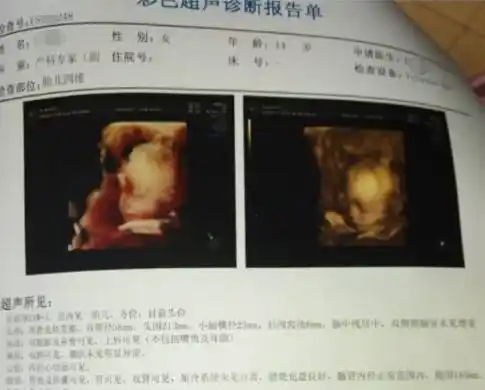 这位14岁怀孕的宝妈还大胆在网上po出自己婴儿超声诊断的报告,"年龄14