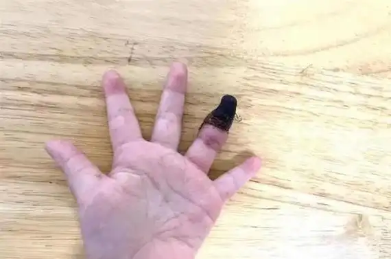 一个动作,手指没了!很多人都会犯