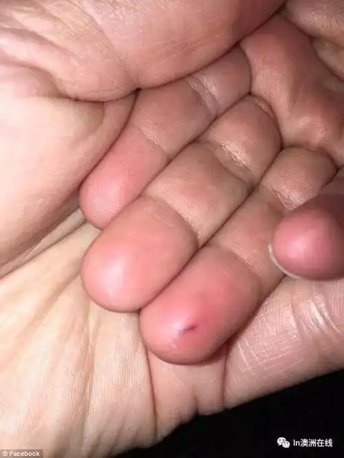 这竟是场故意被亩穸就嫘?