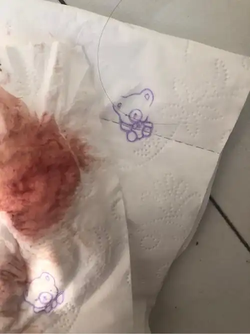 4月1号排卵日今天突然出血了是怎么回事啊