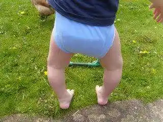 宝宝走路o型腿正常吗要看医生吗