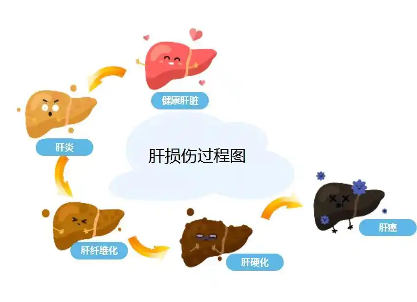 原发性肝癌患者指南系列解读第一期基础及诊断篇圆满落幕