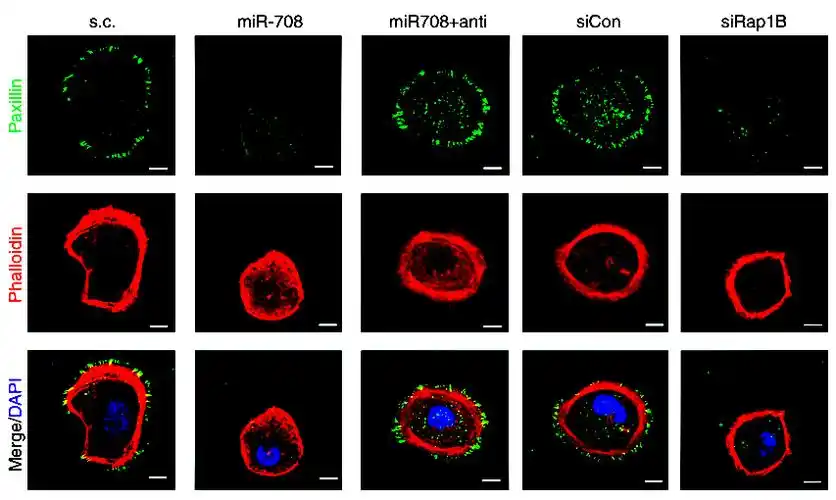 glucocorticoids mediate induction of microrna-708 to suppress