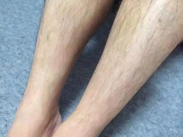 看完或许就明白了|内分泌|腿毛|白皙_网易订阅