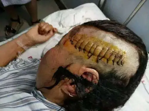 灵宝市苏村乡郭家岭村石当沟,发生持刀砍人案件