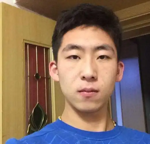 面相中若是一个男人的眼睛污浊不清,三白眼或者四白眼,乃至是眼白有痣