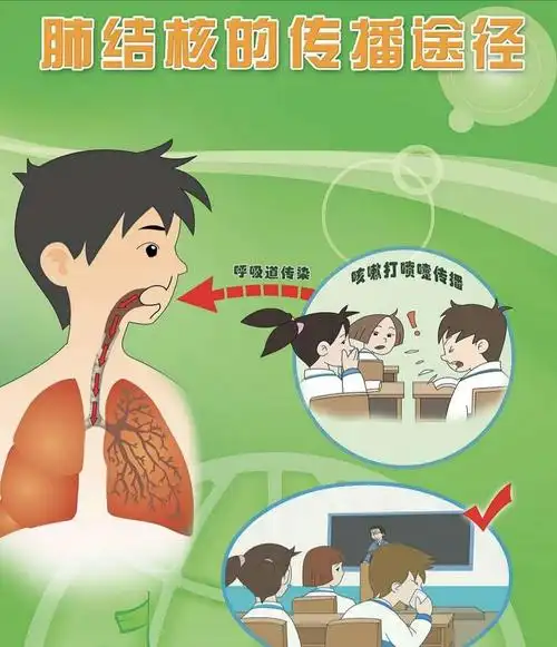 幼儿园结核病预防宣传