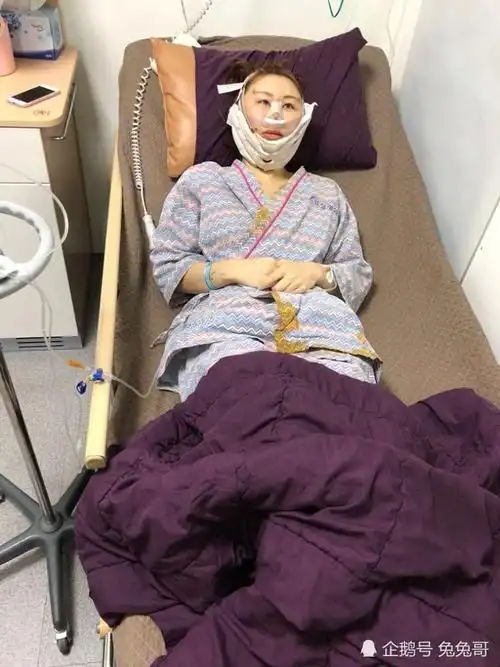 香港女歌手对整容后效果很失望,笑称"为什么我整完不像混血儿"