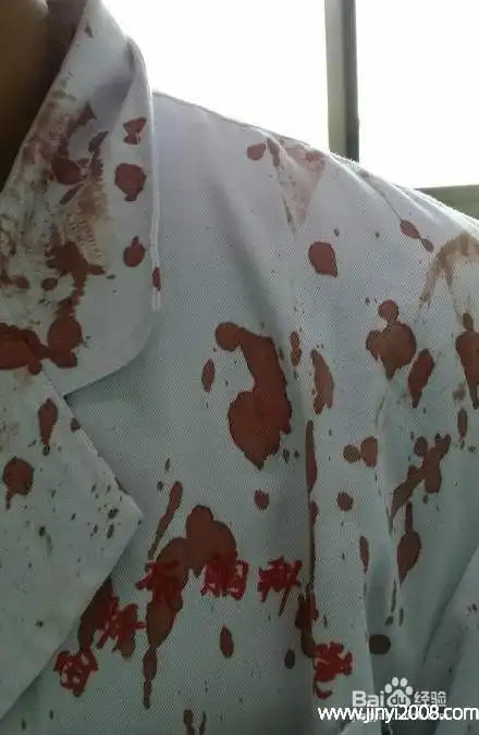 衣服上有血迹怎么才洗得掉衣服上的血渍用什么方法能洗掉