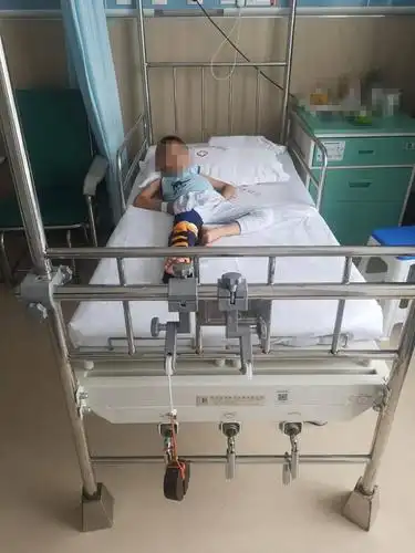 淄博市妇幼保健院:皮肤牵引术在小儿骨科中的临床应用 ——儿童髋关节