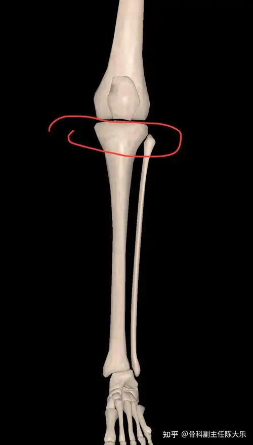 什么是胫腓骨平台