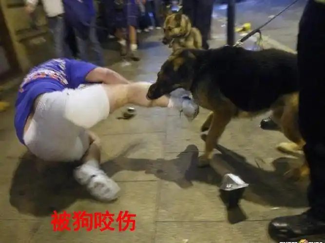 被狗咬伤