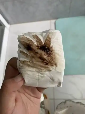 育儿问答 怀孕期 孕早期出血 上完厕所擦屁屁就出现血,会不会导致流产