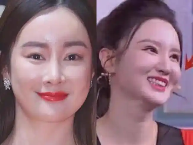 轮廓|高颧骨_网易订阅