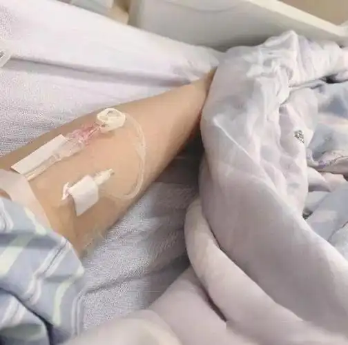 斗鱼主播纳豆因开颅手术剃光头发康复后首次戴假发露脸直播