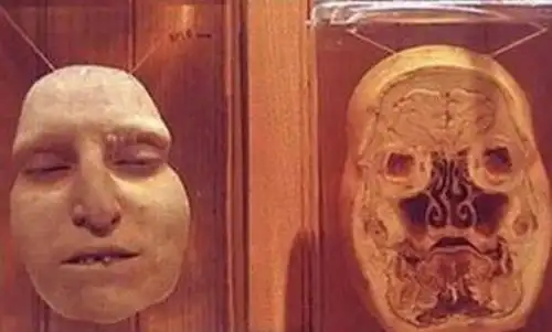 三,与福尔马林共舞的尸体标本