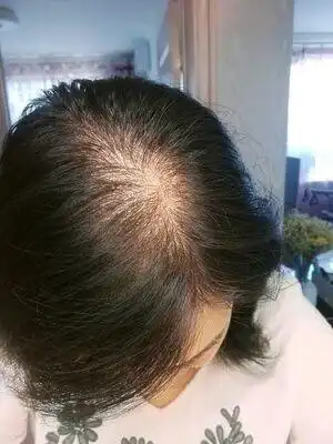 是真发,戴上整理一下,给家人买的,一点也看不出真假了,头顶头发快秃了