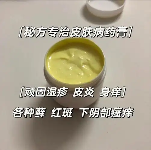 家传秘方专冶各种皮肤病(藓,身痒,湿疹,苔藓,汗藓,各种皮炎,止痒,汗斑