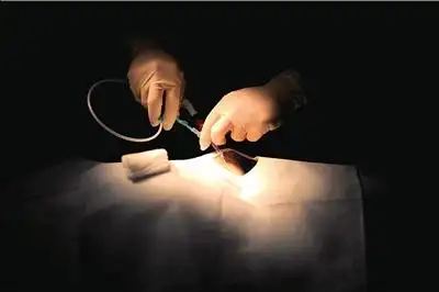 空军总医院内,9岁的藏族女孩才文求措成功接受了先天性心脏病矫治手术