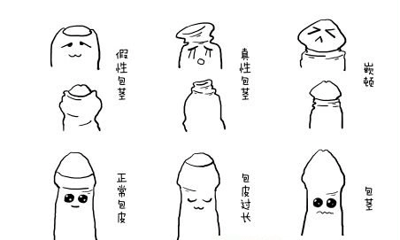 由于包皮外口过小,包皮强行上翻或下翻,使狭小的包皮口紧箍在冠状沟处