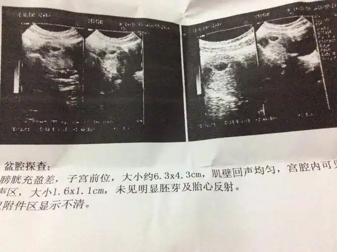 问:我怀孕36天做了一次b超,现在还需要再做一次b超吗.