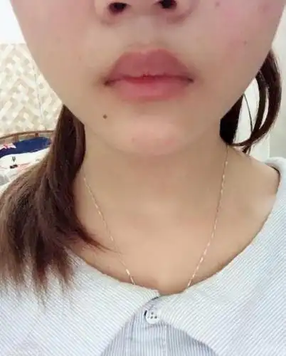 男生眼中最丑的几种唇形,中一个就很影响形象,我没中,你呢?