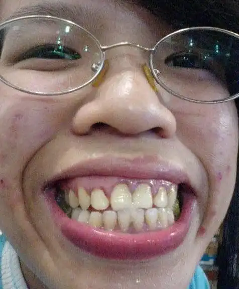 丑到你想吐!网络丑女排行榜top20-美女-养眼搞笑-杭州19楼