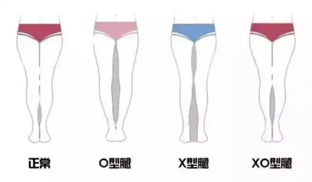 正面和背面都需要,然后根据照片看自己是那种腿型.