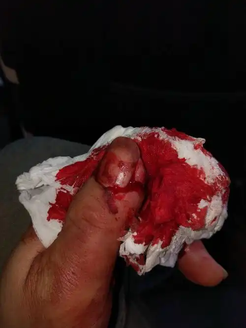 在湖州吴兴区康山街道工地受伤找那个部门