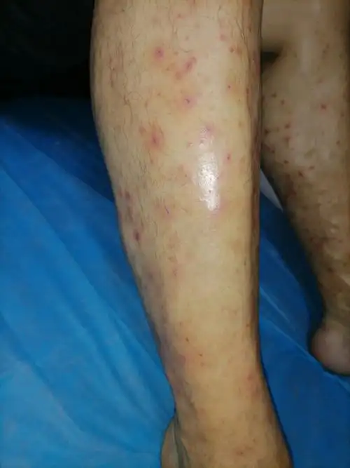 白海军——内经养生坊根治糖尿病