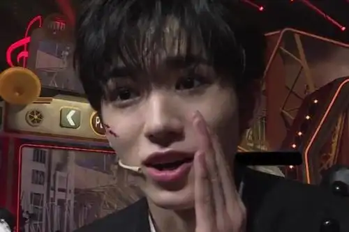 宋亚轩大笑时被怼脸拍,脸上两个坑格外清晰,是否整过一目了然?