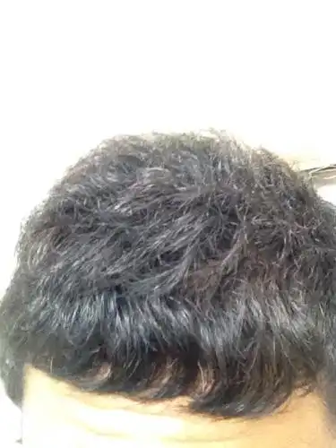 我的自来卷怎么办?很苦恼,大家给出出主意,不软化,太贴头皮