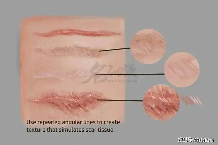 不同类型的伤疤画法教程