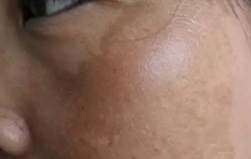 黑龙江肝病专家_黑龙江治疗肝病哪个专家好_黑龙江治疗肝病最好的专家