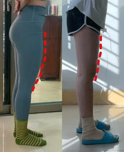 大腿前侧突出练这个这个就够了6015效果嘎嘎好