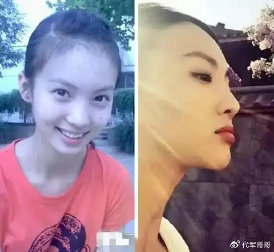 有网友晒出了金晨之前的照片与如今的自拍照相比,完全不一样.
