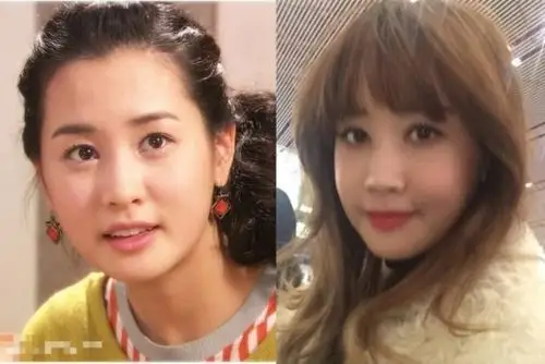 李多海对比照疑似变脸