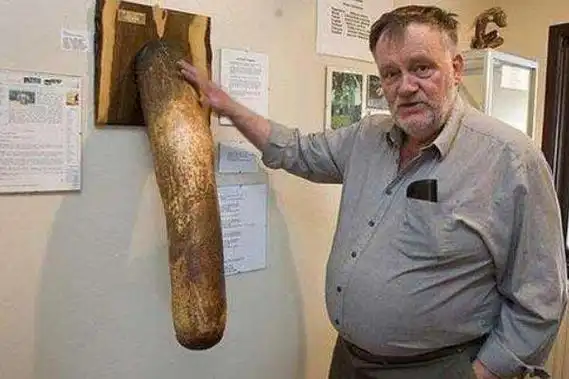 世界上最大的b是多大4826厘米生了236斤的巨婴